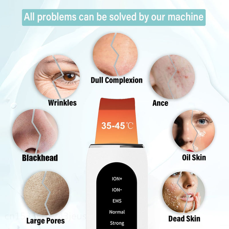 Purificador da Pele Ultrasonic Facial de Limpeza Profunda Anti Acne Remoção de Cravos Peeling